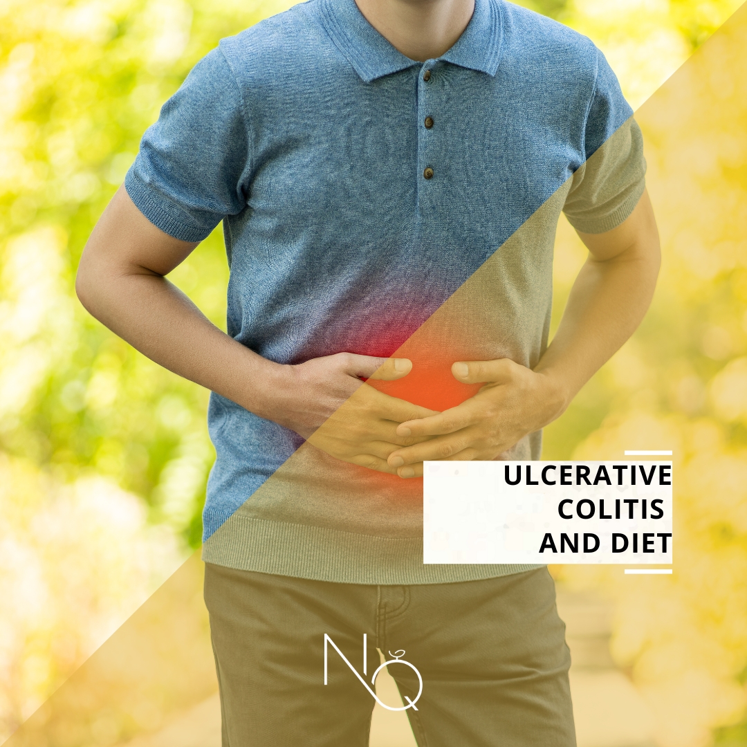 Ulcerative Colitis and Nutrition